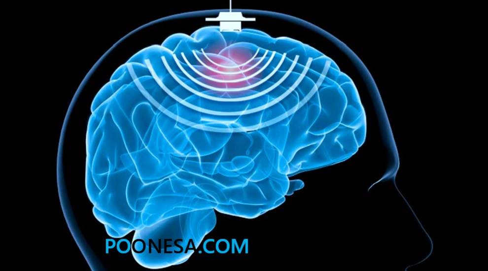 تکنیک‌های تحریک مغز در حال حاضر به افرادی با بیماری پارکینسون و افسردگی کمک می‌کند